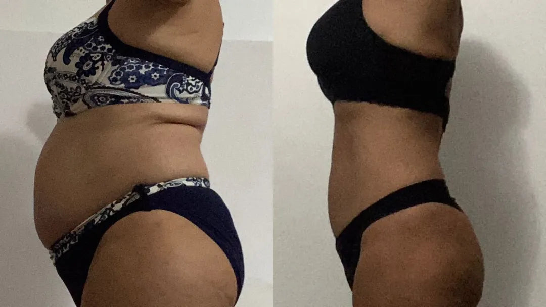 Slim Patch Minceur Hommes et Femmes