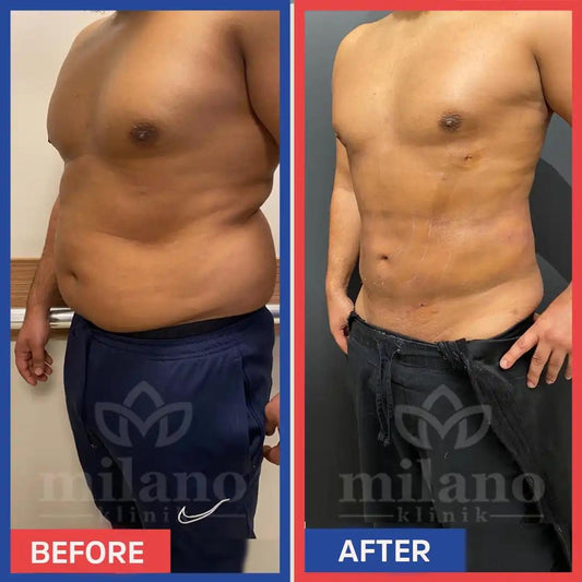 Slim Patch Minceur Hommes et Femmes